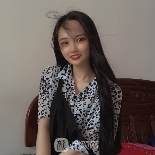 南方医院胡志奇医生头发加密技术怎么样?亲身体验实例公开