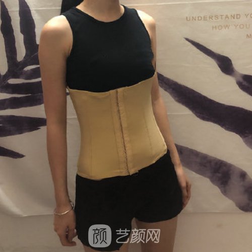 长沙爱思特医疗美容医院正规吗?全新腰腹吸脂实例一览