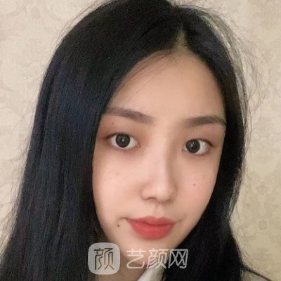 海南华美整形美容医院割双眼皮怎么样?2023风格公开