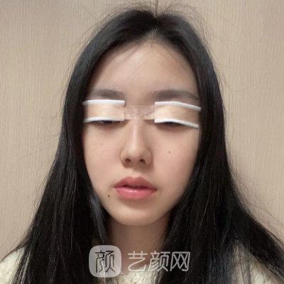 海南华美整形美容医院割双眼皮怎么样?2023风格公开
