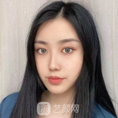 海南华美整形美容医院割双眼皮怎么样?2023风格公开