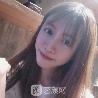 北京华臣谭章梅医生技术怎么样?2023面部脂肪填充实例公开