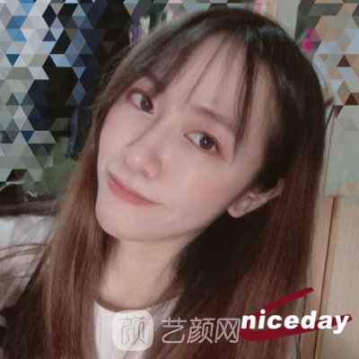 北京华臣谭章梅医生技术怎么样?2023面部脂肪填充实例公开