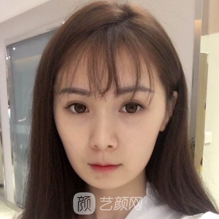 长春中妍奥拉克整形医院口碑怎么样?2023光子嫩肤实例公开