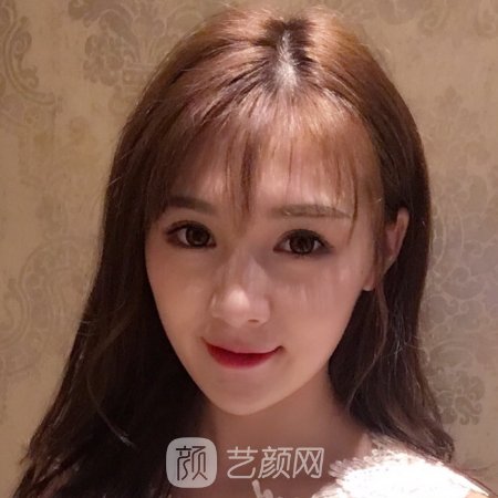长春中妍奥拉克整形医院口碑怎么样?2023光子嫩肤实例公开