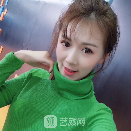 长春中妍奥拉克整形医院口碑怎么样?2023光子嫩肤实例公开