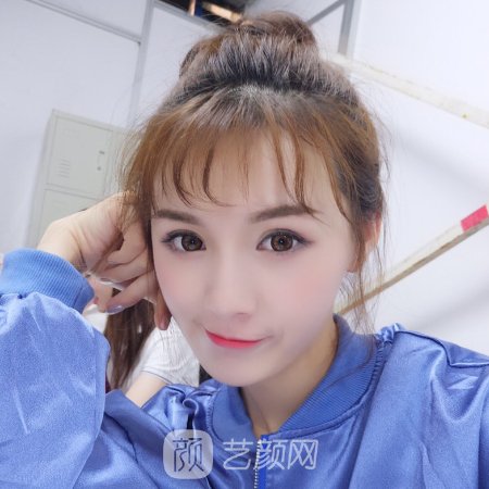 长春中妍奥拉克整形医院口碑怎么样?2023光子嫩肤实例公开