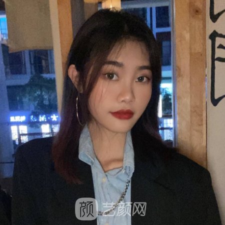 兰州梦想整形医院怎么样?全新注射除皱实例公开