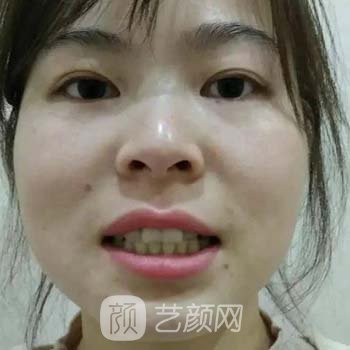 西京医院正畸科骨干医生介绍|口碑点评|牙齿正畸实例鉴赏