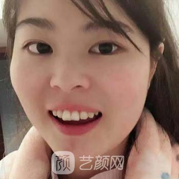西京医院正畸科骨干医生介绍|口碑点评|牙齿正畸实例鉴赏