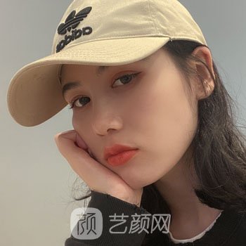 人造酒窝失败修复实例图片，真人修复全过程鉴赏