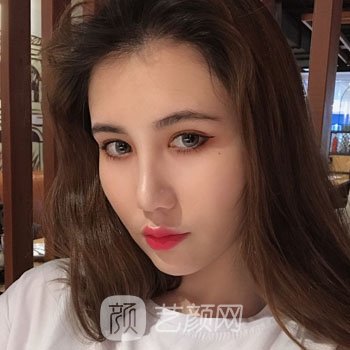 人造酒窝失败修复实例图片，真人修复全过程鉴赏