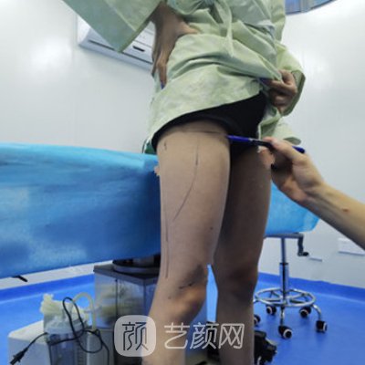 太原丽都整形医院正规吗？全新吸脂整形实例发布