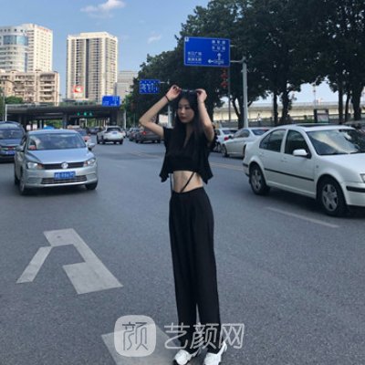 太原丽都整形医院正规吗？全新吸脂整形实例发布