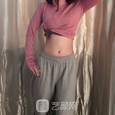 沈阳百嘉丽整形医院腰腹吸脂实例曝光｜成果自然美观