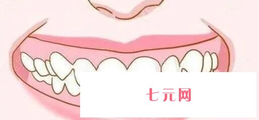 牙齿矫正动漫09.jpg