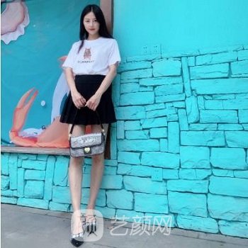 管连斌大腿吸脂实例，纤细美腿，轻松拥有