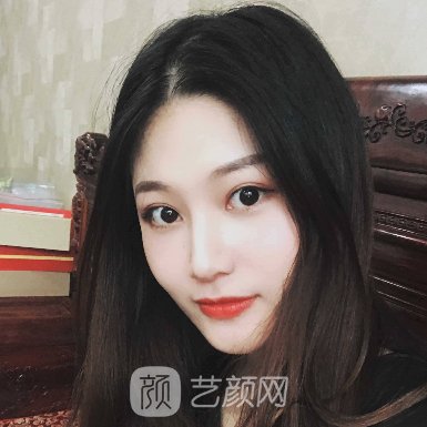 沧州华美整形美容医院怎么样?全新除皱抗衰实例分享