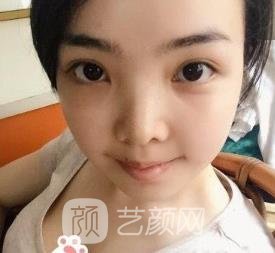 侯振杰外科正牙谁做过？医生详细介绍+正颌实例对比图