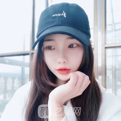 上海一美整形医院怎么样?全新双眼皮实例上线