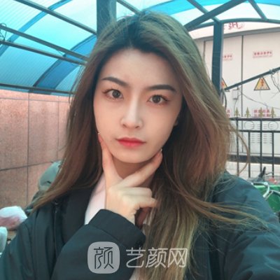 武汉亚韩整形医院注射除皱实例上线|成果自然无痕