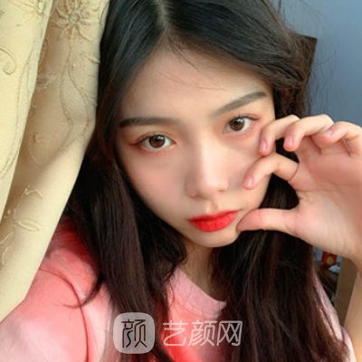 八大处李发成医生做面部脂肪填充怎么样？医生招牌实例出炉