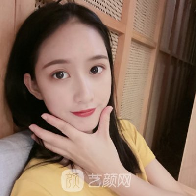 北京东方医院整形科吸脂实例公开|整个人变化了不少