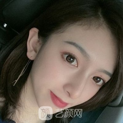 深圳素仁医疗美容医院怎么样？全新除皱抗衰实例分享