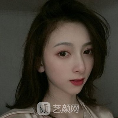 深圳素仁医疗美容医院怎么样？全新除皱抗衰实例分享