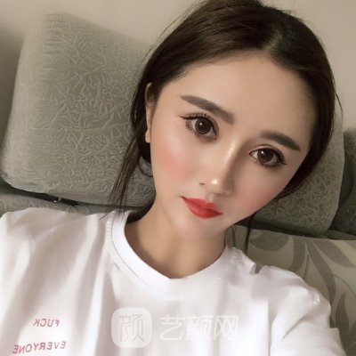 大连医大二院整形科抗衰除皱实例展示|内附体验对比图