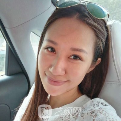 西安画美整形美容医院面部提升实例上线|亲测体验细节分享