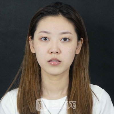 上海柴军医生隆鼻实例出炉|医生实力及实例分享