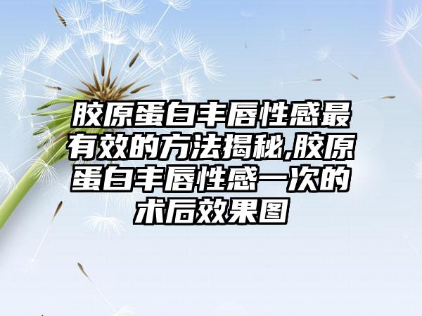 胶原蛋白丰唇性感非常有效的方法揭秘,胶原蛋白丰唇性感一次的术后成果图
