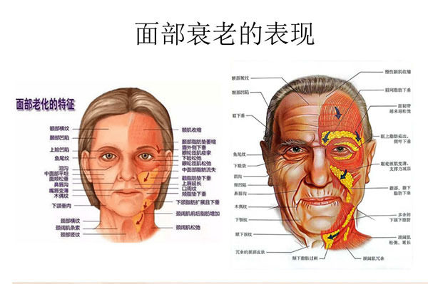 北京加减美黄寅守面部提升怎么样