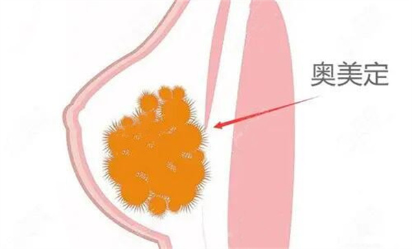 广州荔湾区人民医院邓正军、齐云香清奥怎么样？内窥镜下操作|技术口碑好