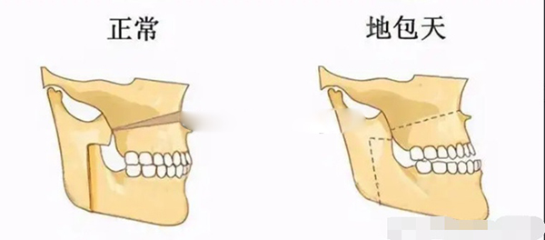 国内正颌手术医院排名前十