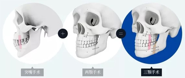 国内正颌手术医生排名前十