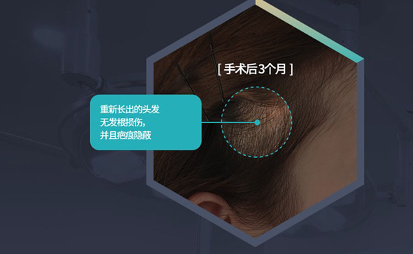 韩国ts整形医院做轮廓怎么样