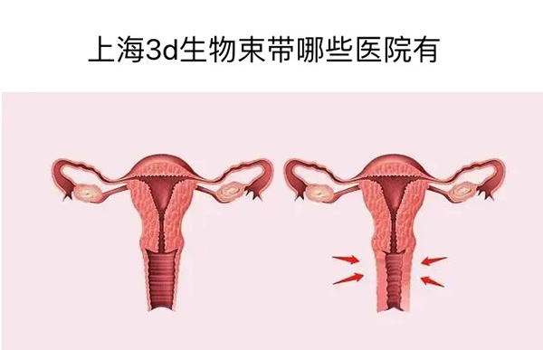 上海3d生物束带哪些医院有:宏康医院/虹桥医院/悦莱整形私密科