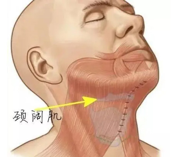 颈阔肌放松下颌缘提升