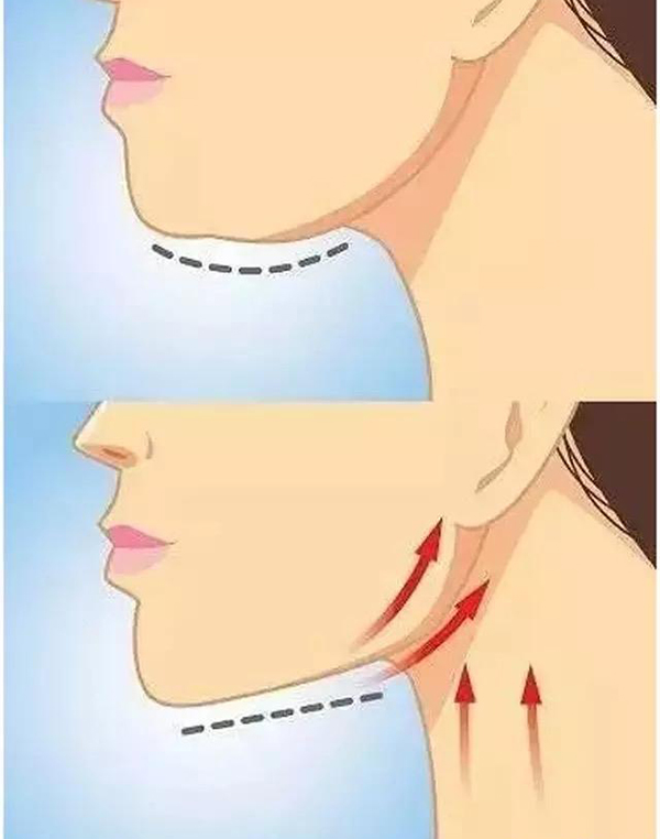 颈阔肌放松下颌缘提升多久有效