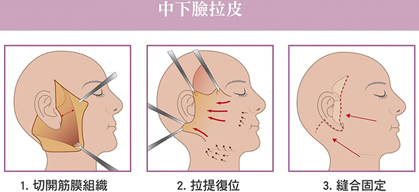 国内拉皮手术医院排名前十及医生