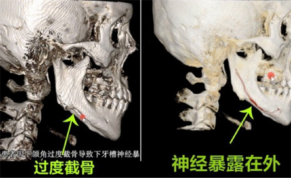 重庆华美潘宝华