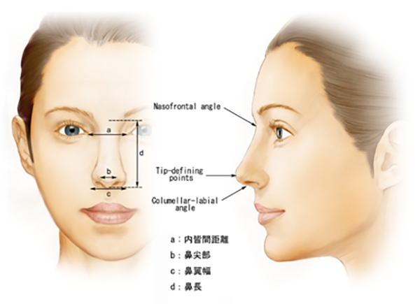 保留性鼻整形术