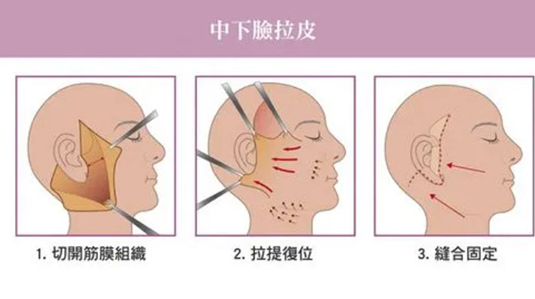 北京八大处拉皮手术哪个医生好？杨欣/王佳琦/解芳医生等技术好