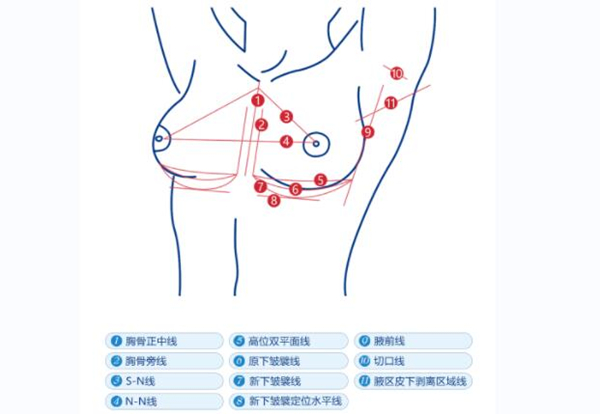 深圳富华整形医院唐新辉隆胸多少钱