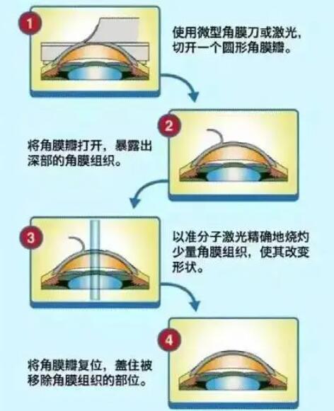 西安市第九医院眼科主任骨干医生有哪些？坐诊医生名单+近视手术实例