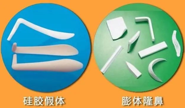 膨体隆鼻假体可以取出来吗?假体隆鼻可以维持多久?