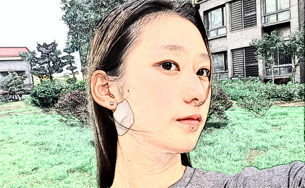磨骨是几级手术呢?磨骨是磨脸部的哪里