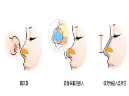 荆州中心医院整形科激光祛斑价目表上线！科室简介_医生擅长_口碑评价出炉了